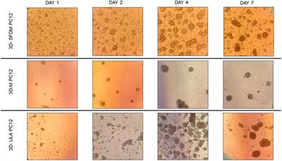 Three Dimensional Cell Culturing for Modeling Adrenal and Pituitary Tumors